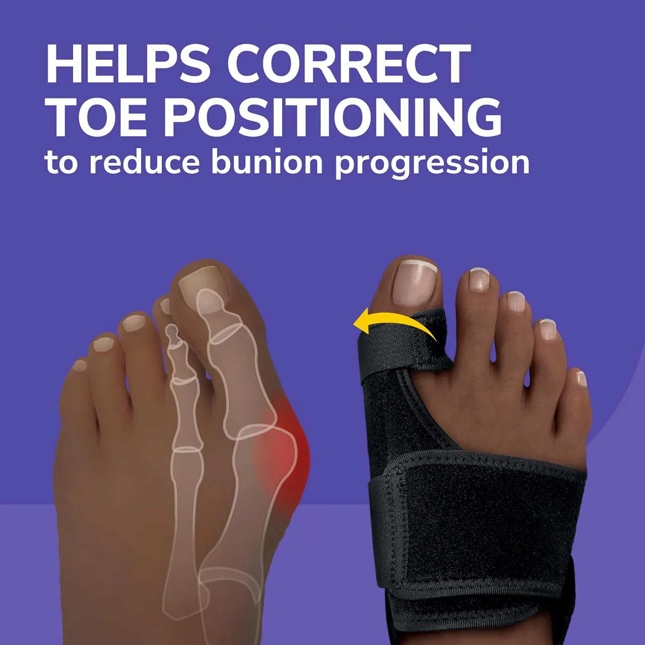 Dr. Scholl's - Bunion Relief & Toe Corrector | 1 Left & 1 Right - Image 2