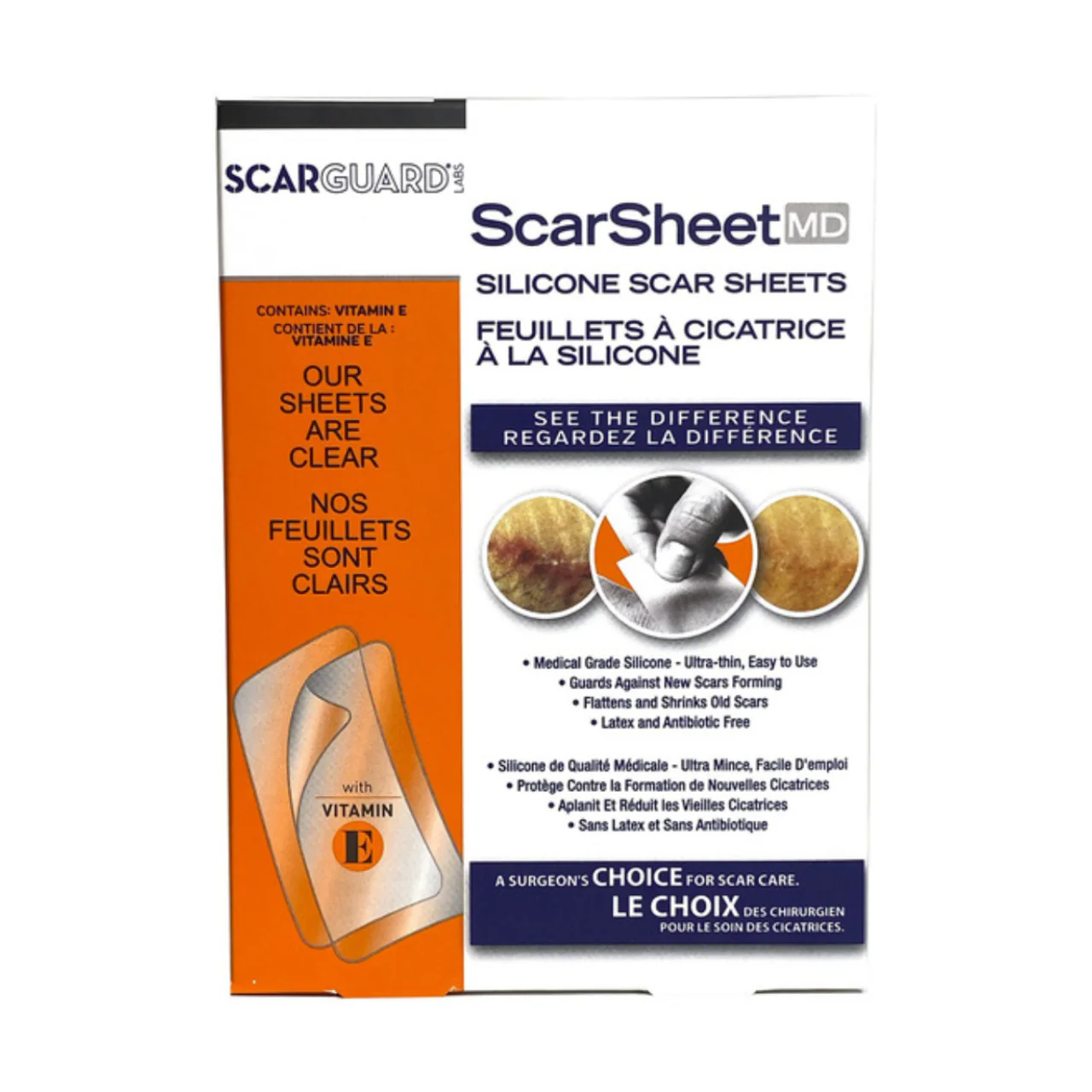 ScarGuard - ScarSheet, Silicone Scar Sheets | 21 Scar Sheets