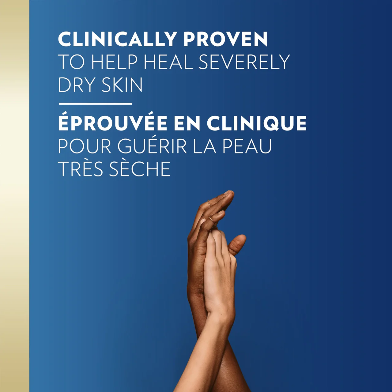 Vaseline - Problem Skin Therapy Body Cream - Unscented | 220 mL - Image 2